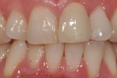 3GDzTPZZQZmoMWBYUzbJJB2i7fH6cw0JPnneQm-NPXM__8r7o993939