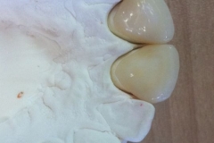 F8un1Gn0oIVv7QApZnIudypWTAuVFTlYM_DH5flQ7Xg__2UGUr20551