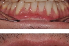 peQ3IFhoyUE9ESx5i-ocdF26bozMwk6wwHBvqa-2zCY__1urCm53102